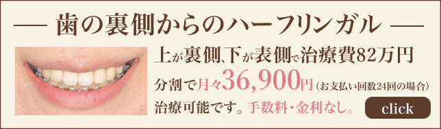 歯の裏側から矯正治療できます