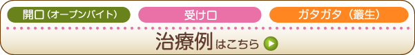 治療例1はこちら