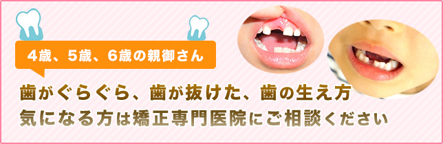 生えかわった前歯の並びが気になる親御さんご相談ください。