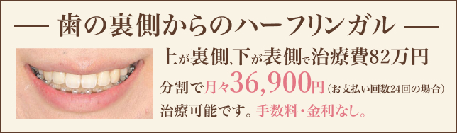 矯正の分割払い